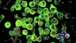 Pediatric patient dies from brain-eating amoeba in South Carolina, officials say